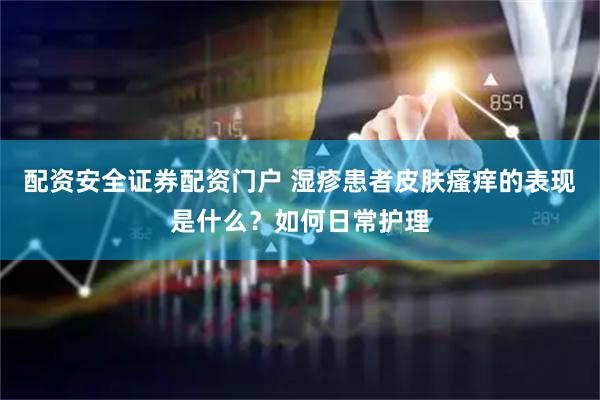 配资安全证券配资门户 湿疹患者皮肤瘙痒的表现是什么？如何日常护理